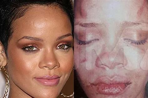 rihanna leaked pics|Alleged Private Photos of Rihanna and Chris Brown Leak